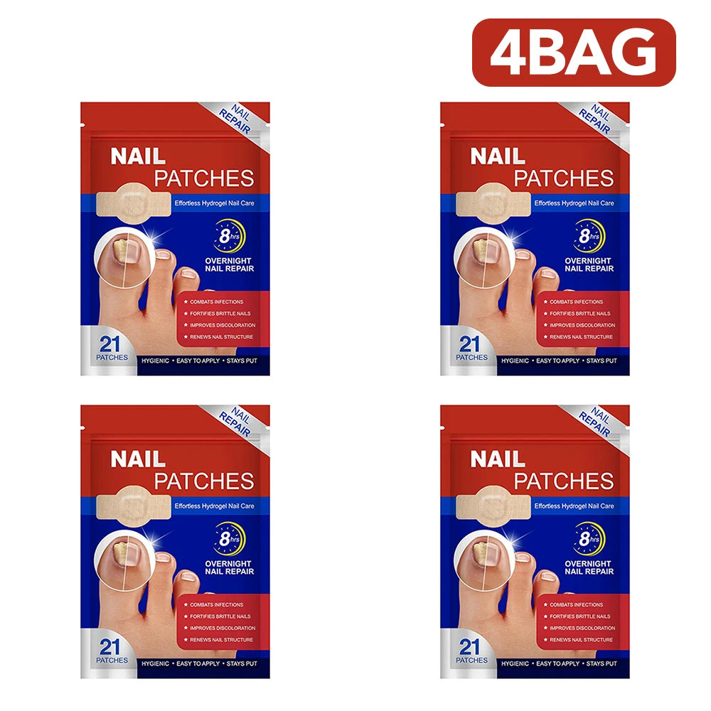 Nail Repair Patch Grey Fungal Nails Thickening Soft Paronychia Treatment Anti Infection Correction Sticker Ingrown Toenail Care