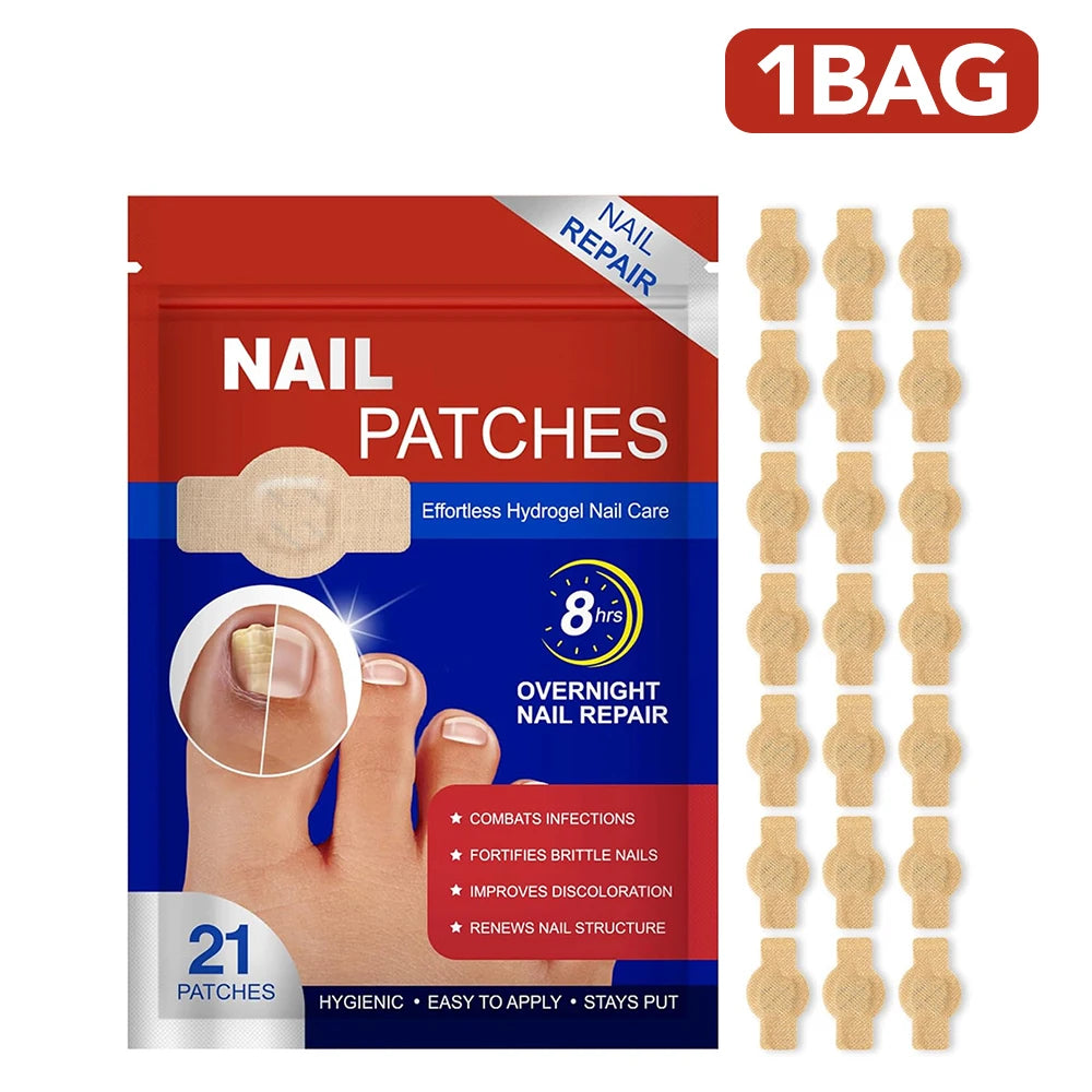 Nail Repair Patch Grey Fungal Nails Thickening Soft Paronychia Treatment Anti Infection Correction Sticker Ingrown Toenail Care