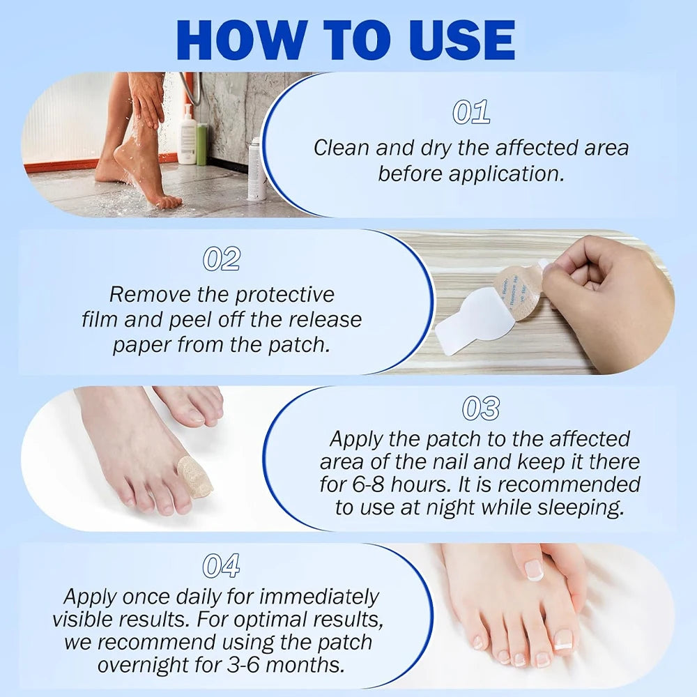 Nail Repair Patch Grey Fungal Nails Thickening Soft Paronychia Treatment Anti Infection Correction Sticker Ingrown Toenail Care