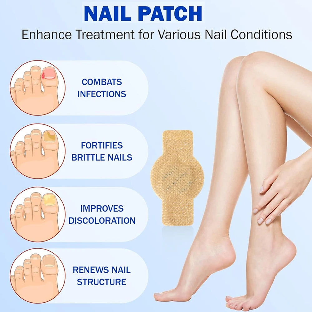 Nail Repair Patch Grey Fungal Nails Thickening Soft Paronychia Treatment Anti Infection Correction Sticker Ingrown Toenail Care